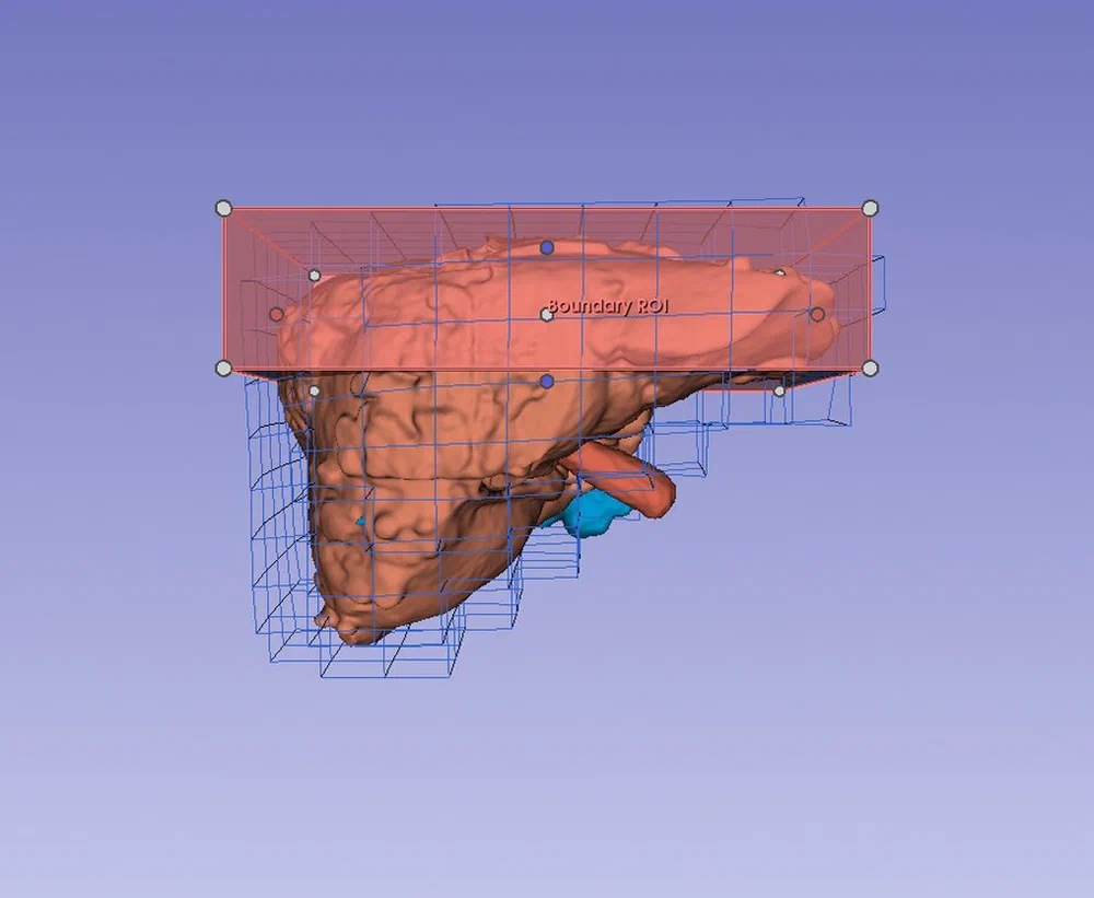 A liver mesh enclosed in the sparse simulation grid its deformation is solved on
