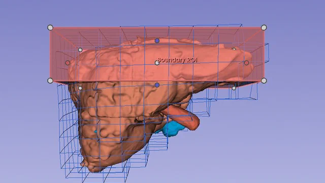 A liver mesh enclosed in the sparse simulation grid its deformation is solved on